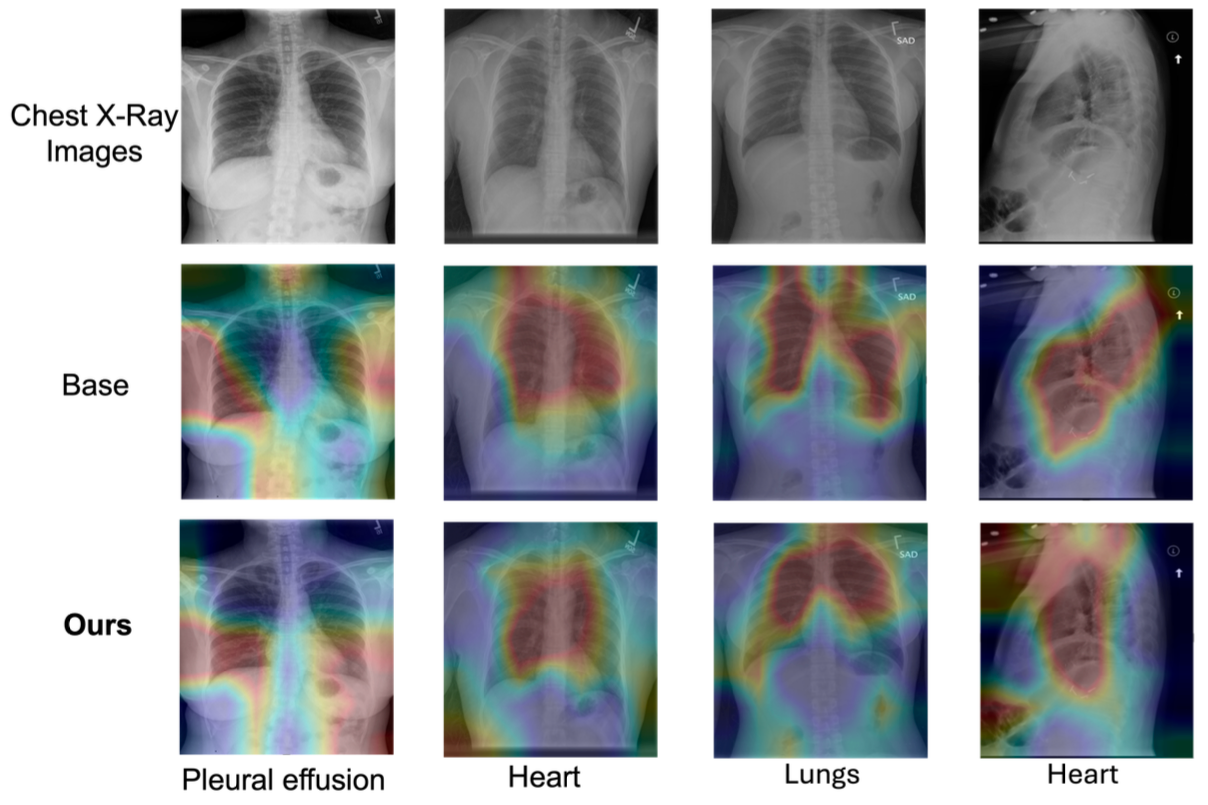 Relative positional encoding in the transformer decoder